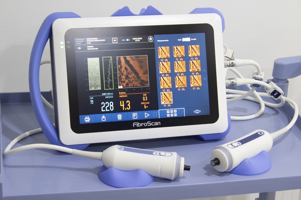 فیبرواسکن کبد