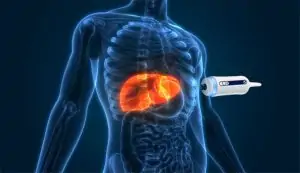 فیبرو اسکن دورهای برای بیماران دیابتی: چرا این تست حیاتی است؟