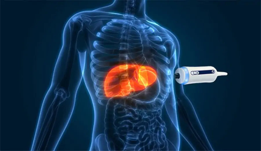 فیبرو اسکن دورهای برای بیماران دیابتی: چرا این تست حیاتی است؟